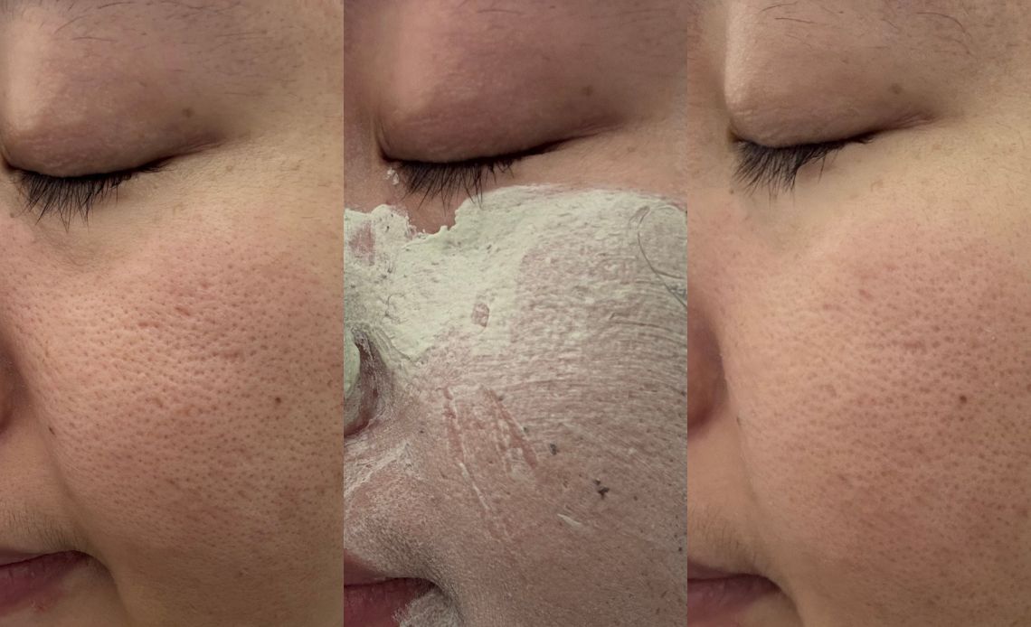 去韓國狂掃！Olive Young熱銷Top1的毛孔保養品，FULLY綠番茄細緻我的月球表面肌！