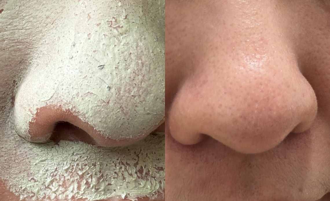 去韓國狂掃！Olive Young熱銷Top1的毛孔保養品，FULLY綠番茄細緻我的月球表面肌！